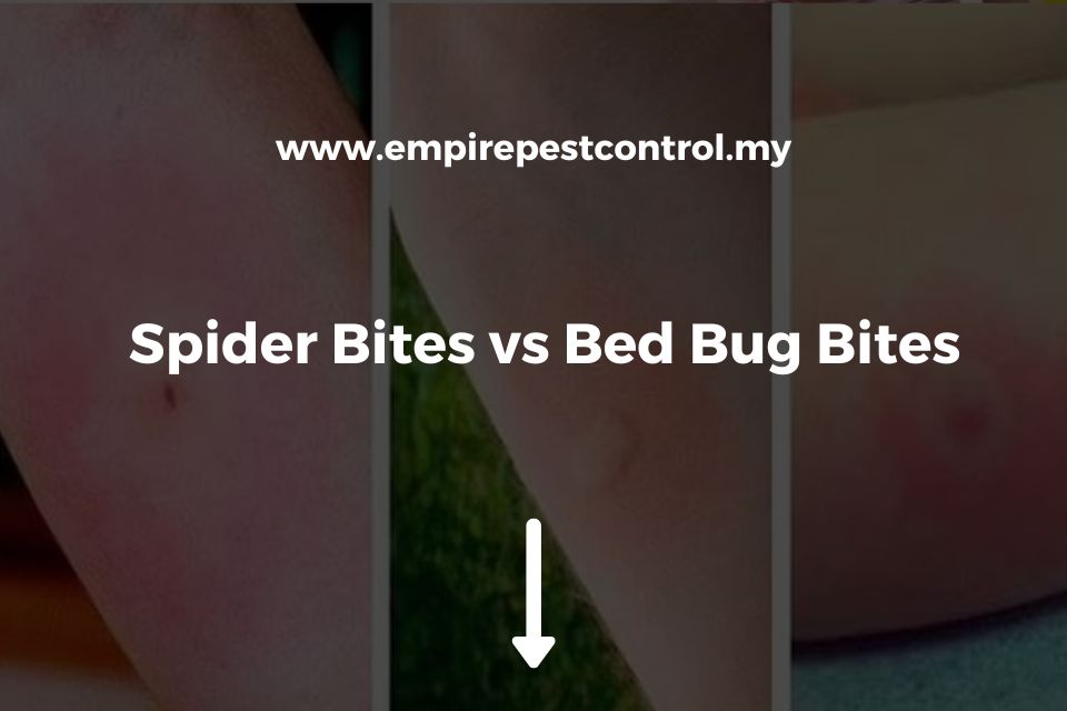 Spider Bites vs Bed Bug Bites